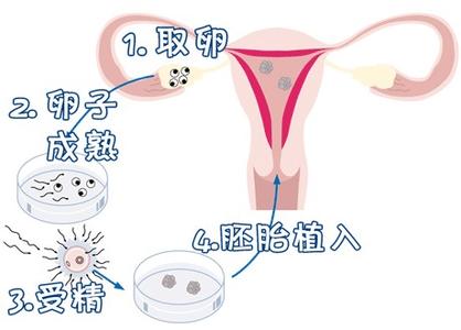 供卵代怀价格